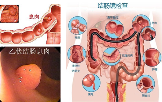 萎縮性胃炎真的“很?chē)樔恕?？看完這“七個(gè)事實(shí)”你就明白了
